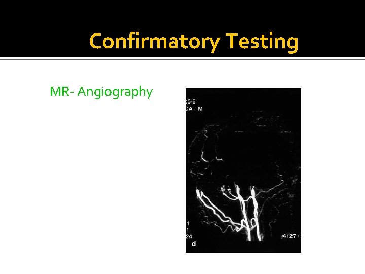 Confirmatory Testing MR- Angiography 