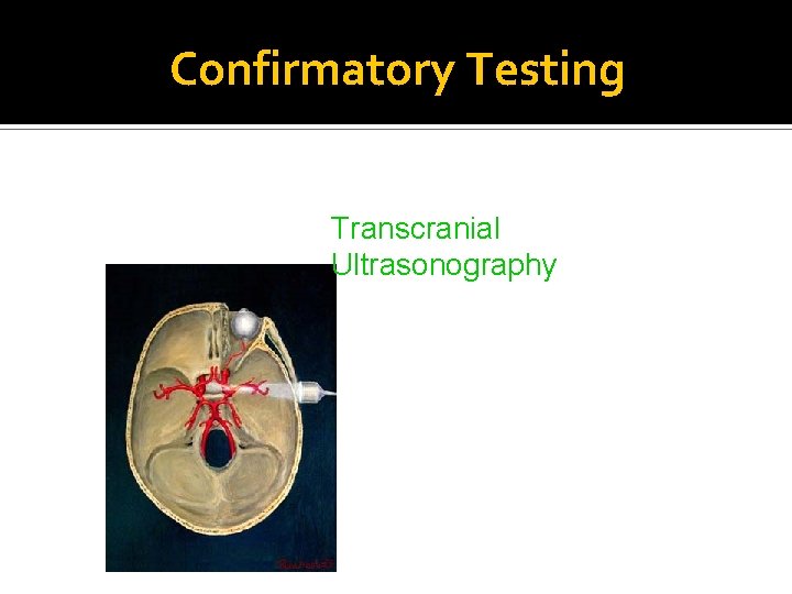 Confirmatory Testing Transcranial Ultrasonography 