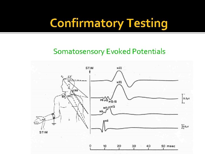 Confirmatory Testing Somatosensory Evoked Potentials 