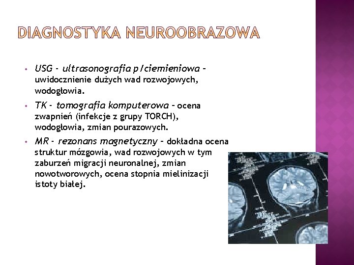  • USG - ultrasonografia p/ciemieniowa – uwidocznienie dużych wad rozwojowych, wodogłowia. • TK