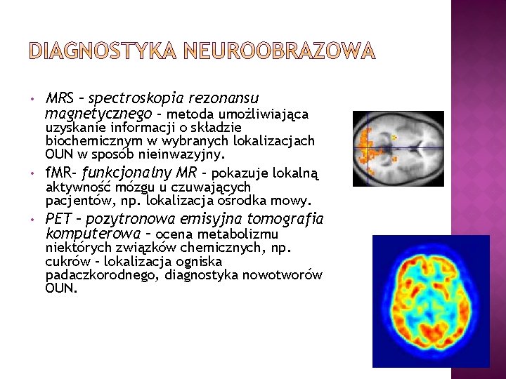  • MRS – spectroskopia rezonansu magnetycznego – metoda umożliwiająca uzyskanie informacji o składzie