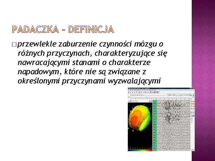 � przewlekle zaburzenie czynności mózgu o różnych przyczynach, charakteryzujące się nawracającymi stanami o charakterze � przewlekle zaburzenie czynności mózgu o różnych przyczynach, charakteryzujące się nawracającymi stanami o charakterze