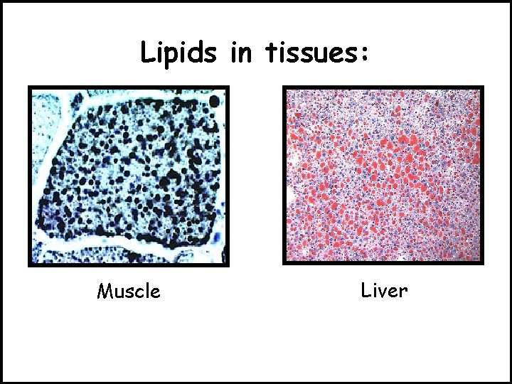 Lipids in tissues: Muscle Liver 