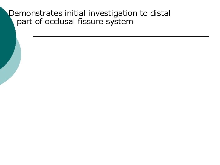 Demonstrates initial investigation to distal part of occlusal fissure system 