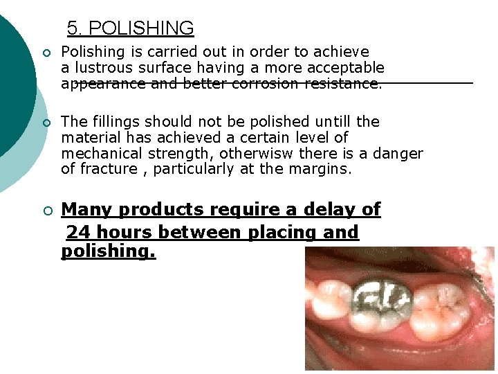 5. POLISHING ¡ Polishing is carried out in order to achieve a lustrous surface