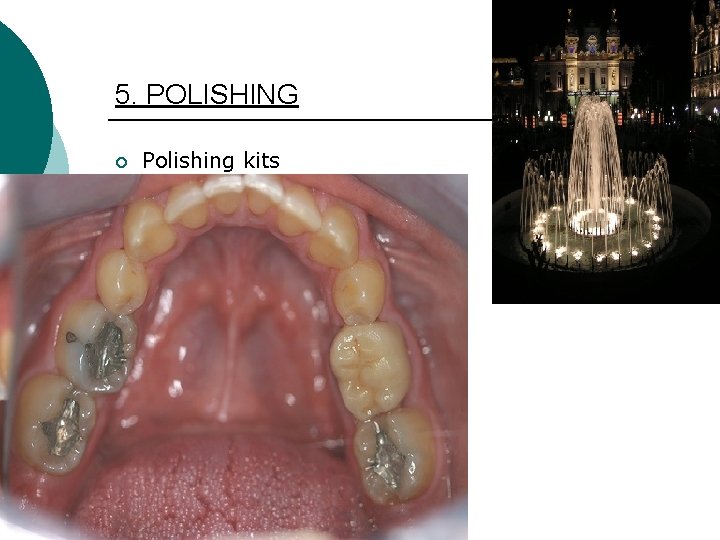 5. POLISHING ¡ Polishing kits 