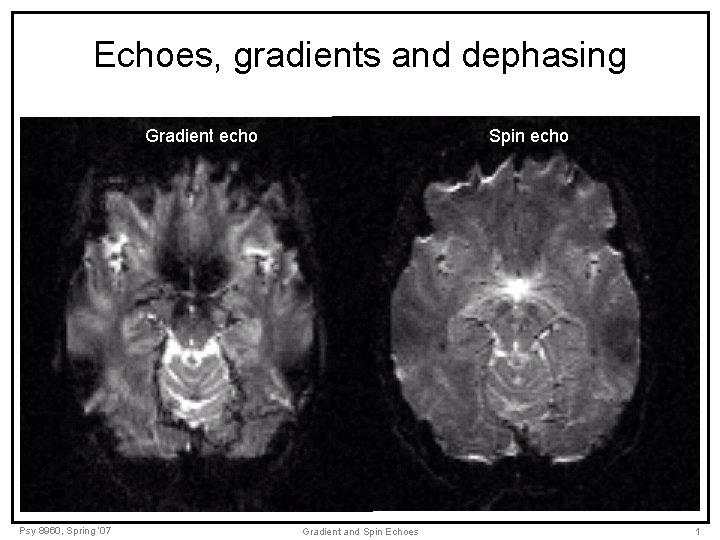 Echoes, gradients and dephasing Gradient echo Psy 8960, Spring ‘ 07 Spin echo Gradient