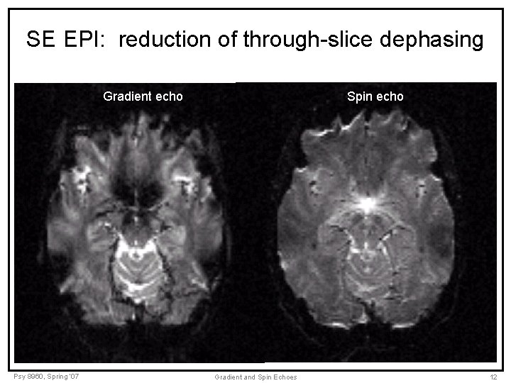 SE EPI: reduction of through-slice dephasing Gradient echo Psy 8960, Spring ‘ 07 Spin