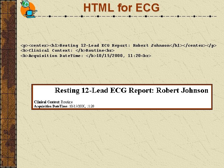 HTML for ECG <p><center><h 1>Resting 12 -Lead ECG Report: Robert Johnson</h 1></center></p> <b>Clinical Context: