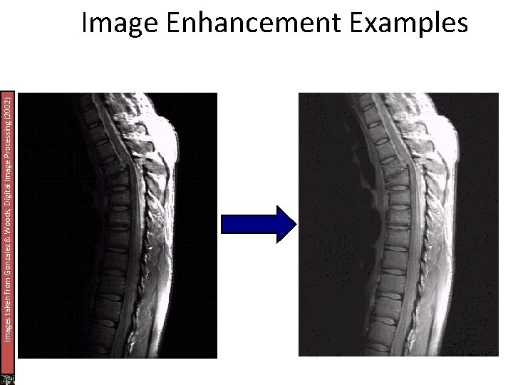 Images taken from Gonzalez & Woods, Digital Image Processing (2002) Image Enhancement Examples 