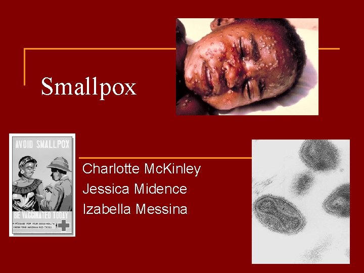 Smallpox Charlotte Mc. Kinley Jessica Midence Izabella Messina 