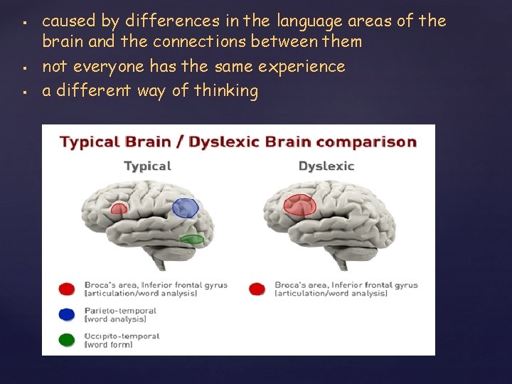 § § § caused by differences in the language areas of the brain and