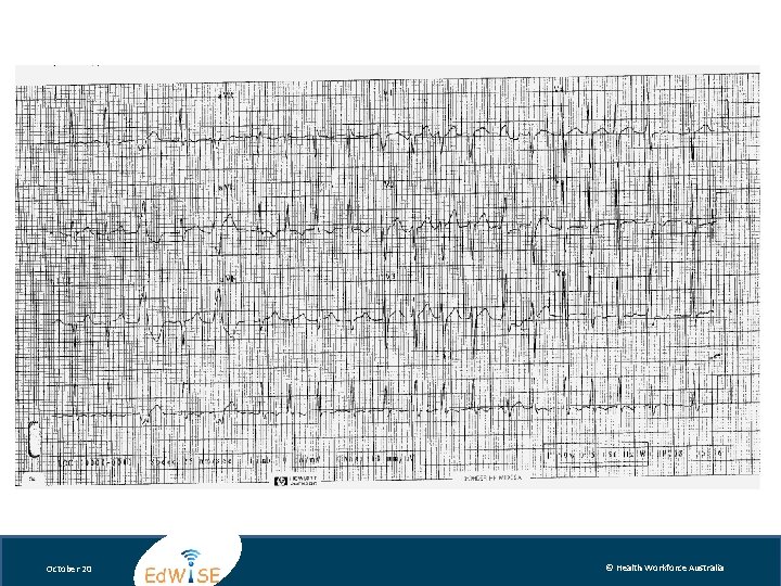 October 20 © Health Workforce Australia 