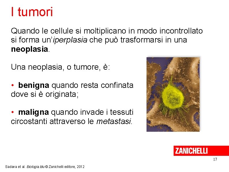 I tumori Quando le cellule si moltiplicano in modo incontrollato si forma un’iperplasia che