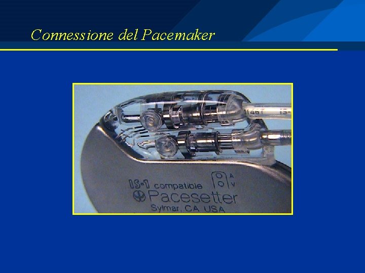 Connessione del Pacemaker 