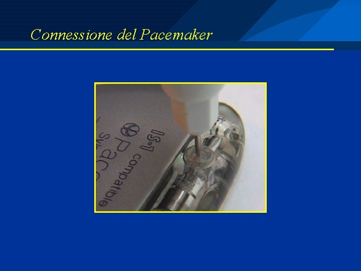 Connessione del Pacemaker 