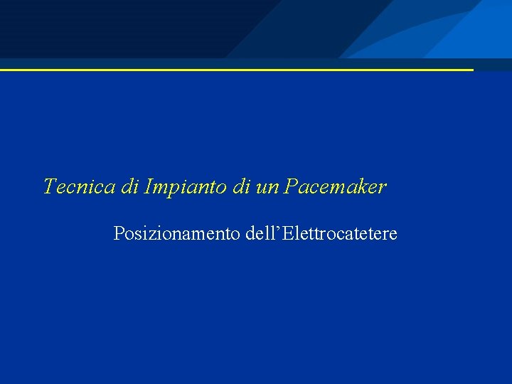 Tecnica di Impianto di un Pacemaker Posizionamento dell’Elettrocatetere 