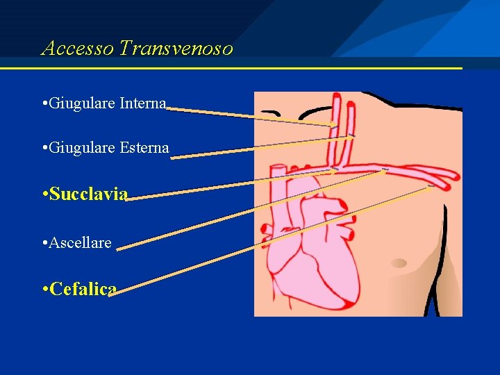 Accesso Transvenoso • Giugulare Interna • Giugulare Esterna • Succlavia • Ascellare • Cefalica