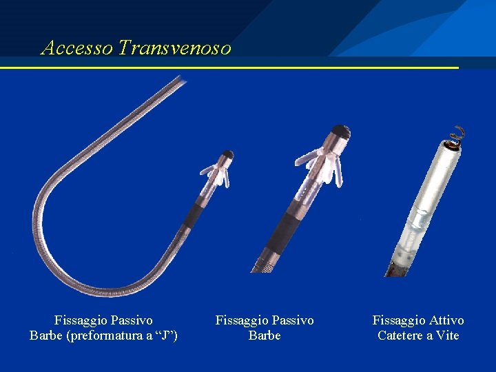 Accesso Transvenoso Fissaggio Passivo Barbe (preformatura a “J”) Fissaggio Passivo Barbe Fissaggio Attivo Catetere