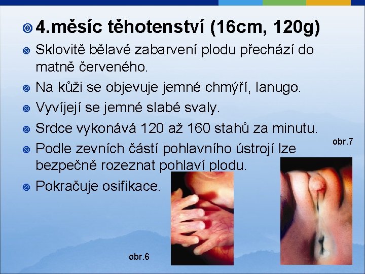 ¥ 4. měsíc ¥ ¥ ¥ těhotenství (16 cm, 120 g) Sklovitě bělavé zabarvení