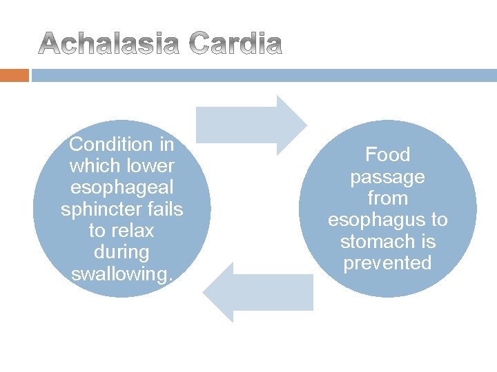 Condition in which lower esophageal sphincter fails to relax during swallowing. Food passage from