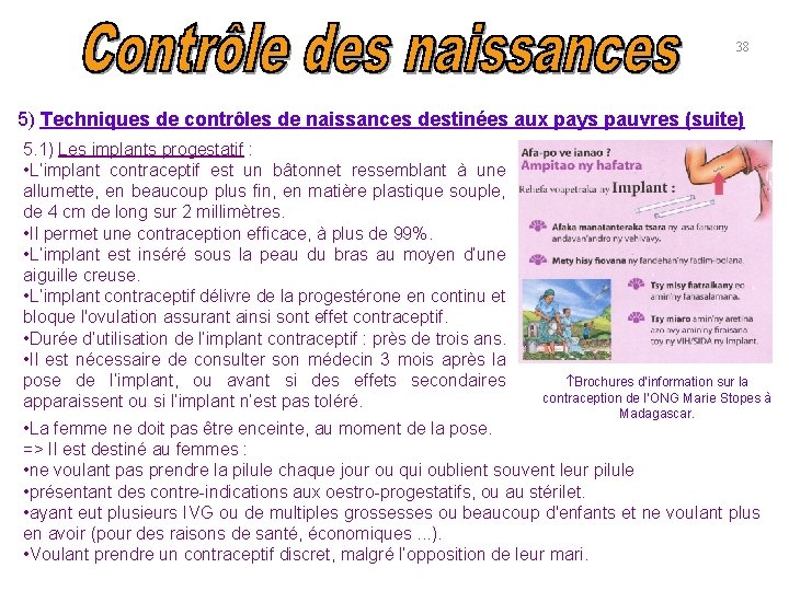 38 5) Techniques de contrôles de naissances destinées aux pays pauvres (suite) 5. 1)