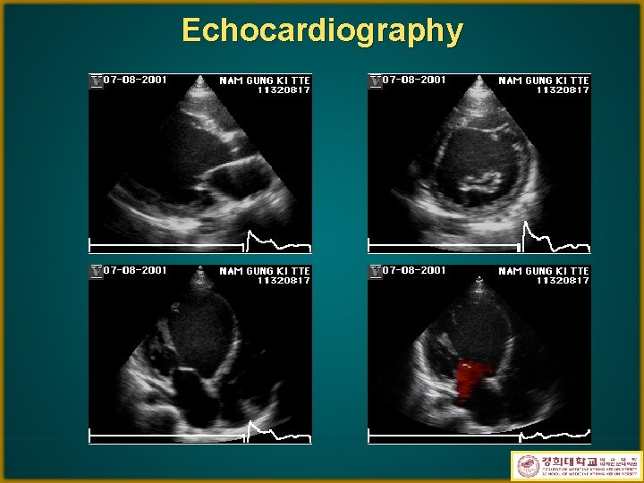 Echocardiography 