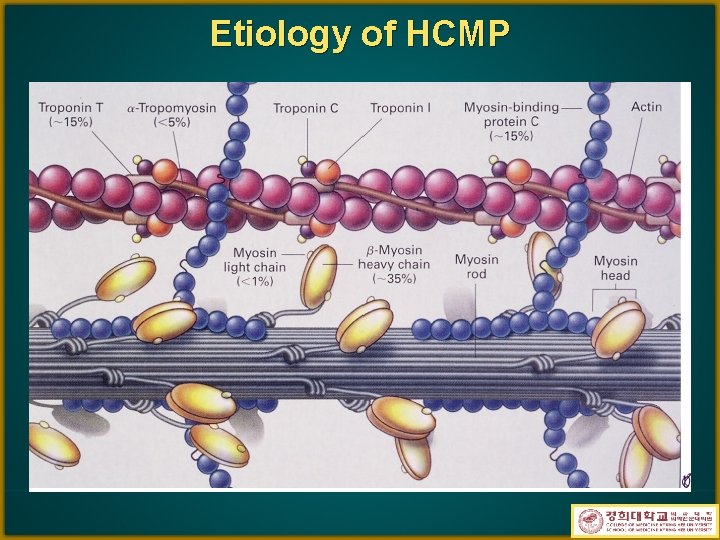 Etiology of HCMP 