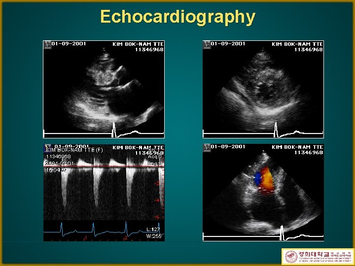 Echocardiography 