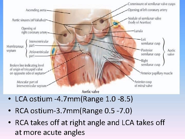  • LCA ostium -4. 7 mm(Range 1. 0 -8. 5) • RCA ostium-3.