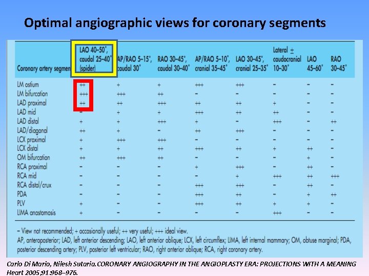 Optimal angiographic views for coronary segments Carlo Di Mario, Nilesh Sutaria. CORONARY ANGIOGRAPHY IN