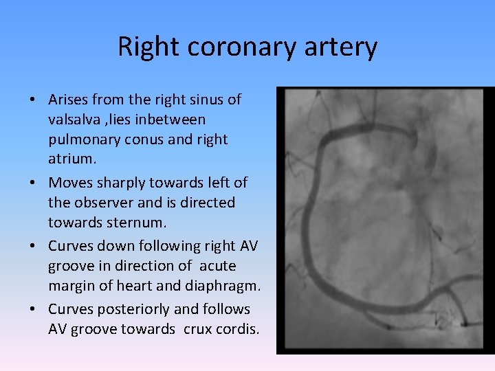 Right coronary artery • Arises from the right sinus of valsalva , lies inbetween