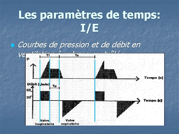 Les paramètres de temps: I/E n Courbes de pression et de débit en ventilation