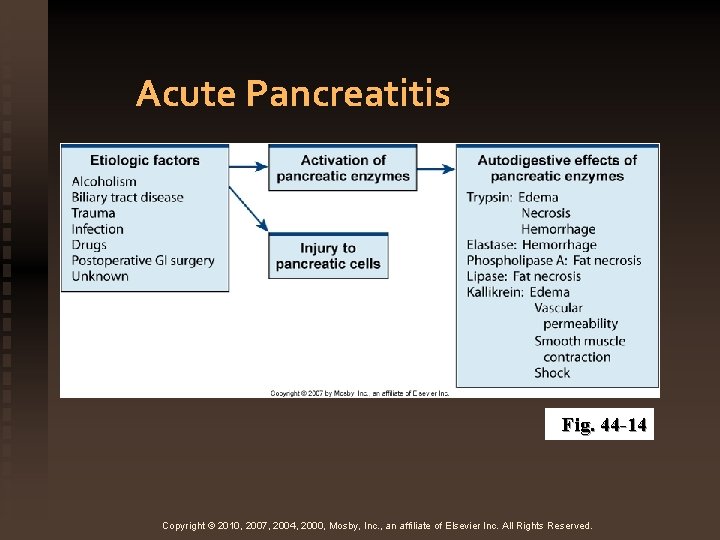 Acute Pancreatitis Fig. 44 -14 Copyright © 2010, 2007, 2004, 2000, Mosby, Inc. ,