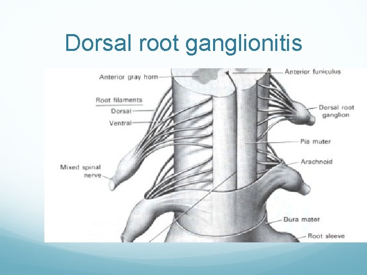 Dorsal root ganglionitis 