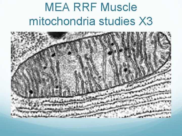 MEA RRF Muscle mitochondria studies X 3 