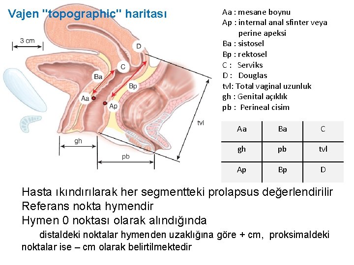 Vajen "topographic" haritası Aa : mesane boynu Ap : internal anal sfinter veya perine Vajen "topographic" haritası Aa : mesane boynu Ap : internal anal sfinter veya perine