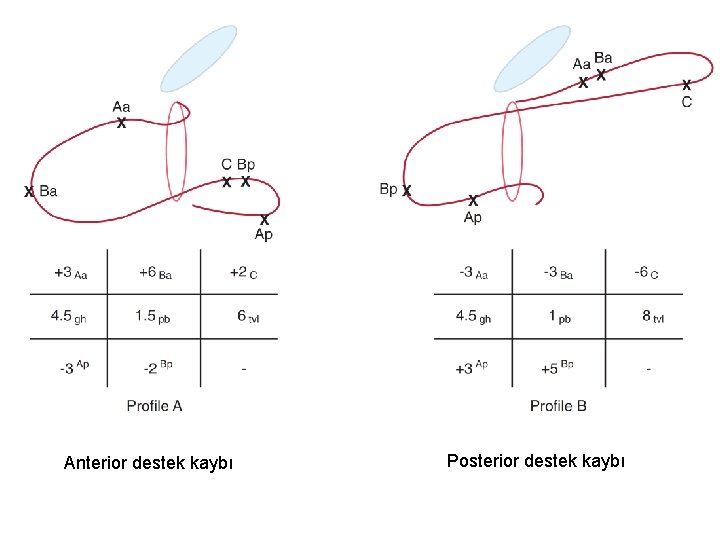 Anterior destek kaybı Posterior destek kaybı Anterior destek kaybı Posterior destek kaybı
