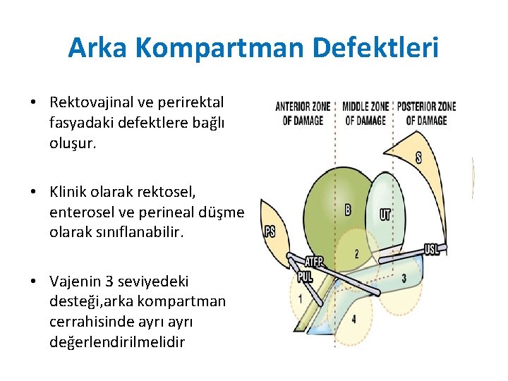 Arka Kompartman Defektleri • Rektovajinal ve perirektal fasyadaki defektlere bağlı oluşur. • Klinik olarak Arka Kompartman Defektleri • Rektovajinal ve perirektal fasyadaki defektlere bağlı oluşur. • Klinik olarak