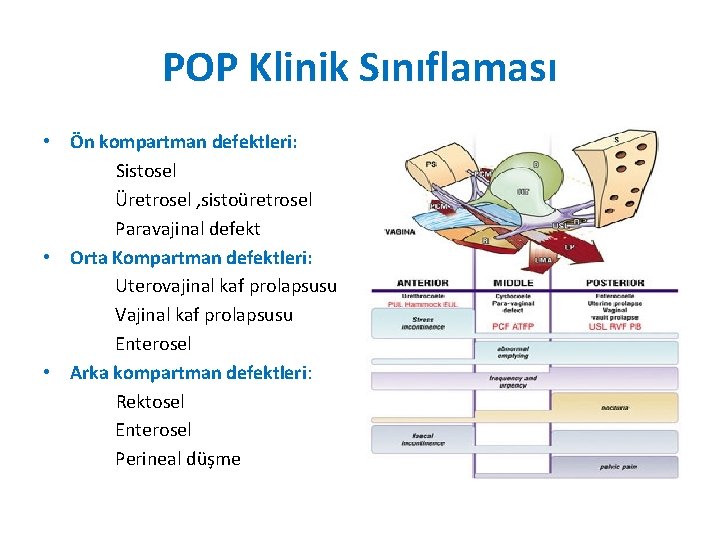 POP Klinik Sınıflaması • Ön kompartman defektleri: Sistosel Üretrosel , sistoüretrosel Paravajinal defekt • POP Klinik Sınıflaması • Ön kompartman defektleri: Sistosel Üretrosel , sistoüretrosel Paravajinal defekt •