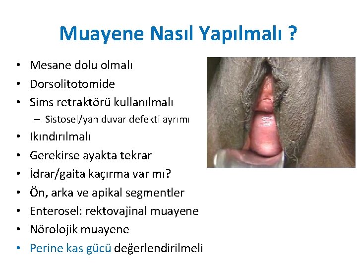 Muayene Nasıl Yapılmalı ? • Mesane dolu olmalı • Dorsolitotomide • Sims retraktörü kullanılmalı Muayene Nasıl Yapılmalı ? • Mesane dolu olmalı • Dorsolitotomide • Sims retraktörü kullanılmalı