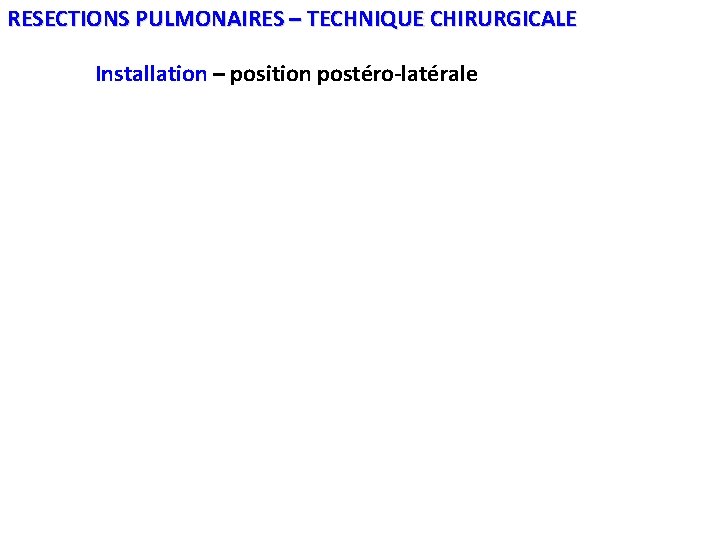 RESECTIONS PULMONAIRES – TECHNIQUE CHIRURGICALE Installation – position postéro-latérale 