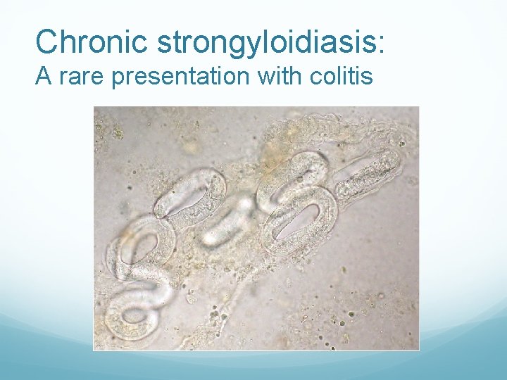 Chronic strongyloidiasis: A rare presentation with colitis 