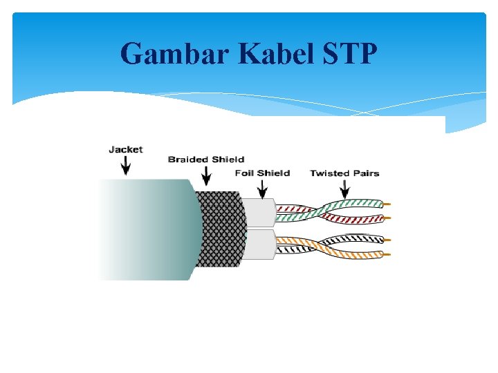 Gambar Kabel STP 