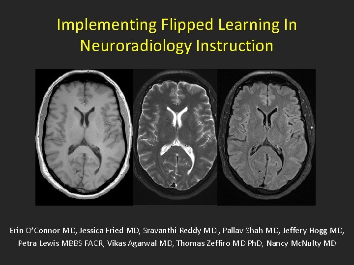 Implementing Flipped Learning In Neuroradiology Instruction Erin O’Connor MD, Jessica Fried MD, Sravanthi Reddy