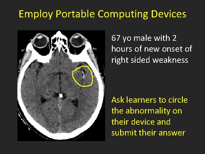 Employ Portable Computing Devices 67 yo male with 2 hours of new onset of
