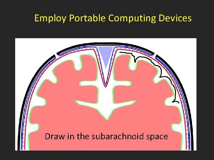 Employ Portable Computing Devices Draw in the subarachnoid space 