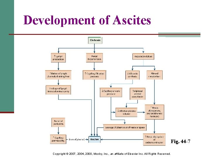 Development of Ascites Fig. 44 -7 Copyright © 2007, 2004, 2000, Mosby, Inc. ,