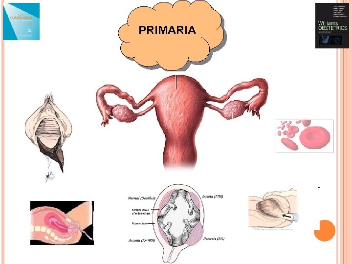 PRIMARIA 