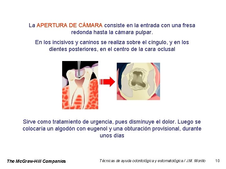 La APERTURA DE CÁMARA consiste en la entrada con una fresa redonda hasta la